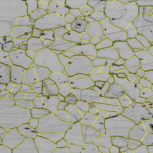 Grayscale micrograph showing polygonal cells outlined in yellow with scattered dark spots.