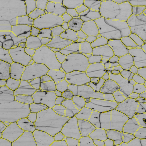Grayscale micrograph showing polygonal cells outlined in yellow with scattered dark spots.