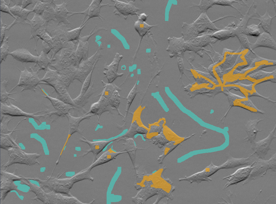 Gray microscopy image with teal and orange segmented overlays and small orange square markers