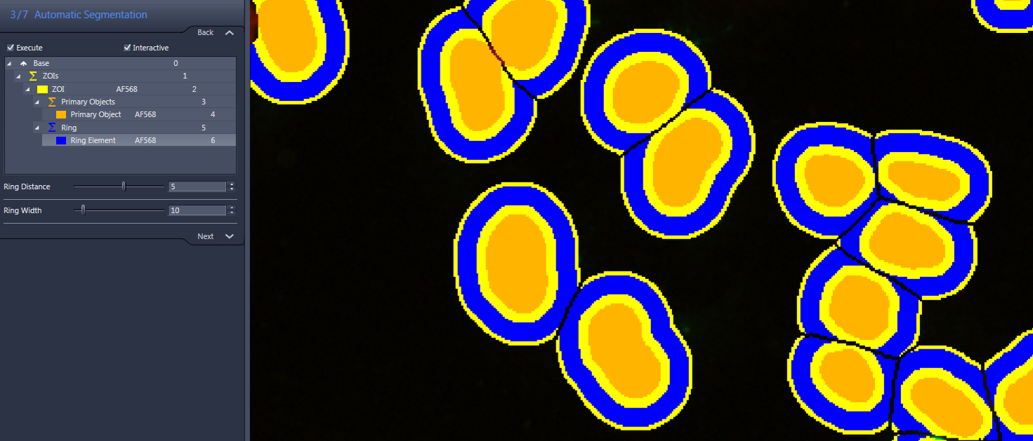 Dark image showing orange objects with blue rings and yellow ZOI overlays; left panel reads '3/7 Automatic Segmentation'