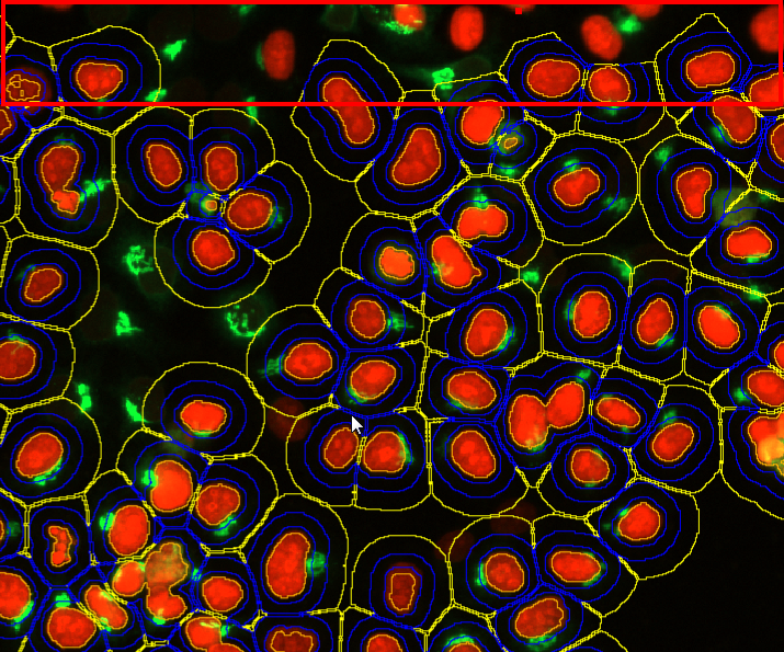 Fluorescent image of many red ovals with blue rings and yellow outlines on black background and scattered green spots