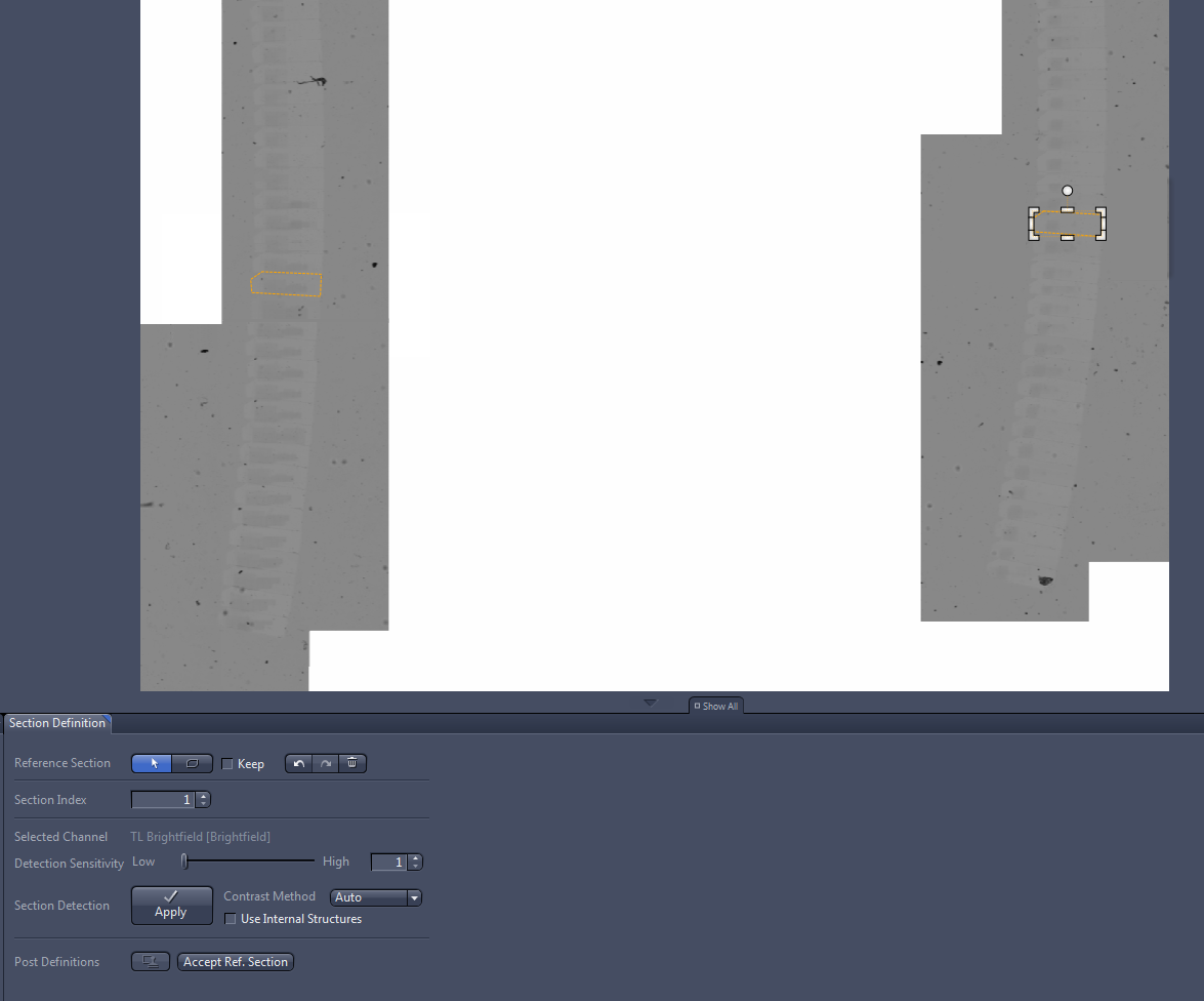 Acquisition Wizard 4/7 screenshot showing two gray vertical ribbons with green outlined sections.