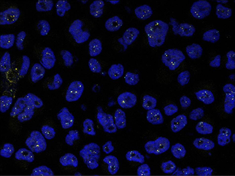 Fluorescent microscopy image of blue cell nuclei with scattered yellow-green puncta on a black background