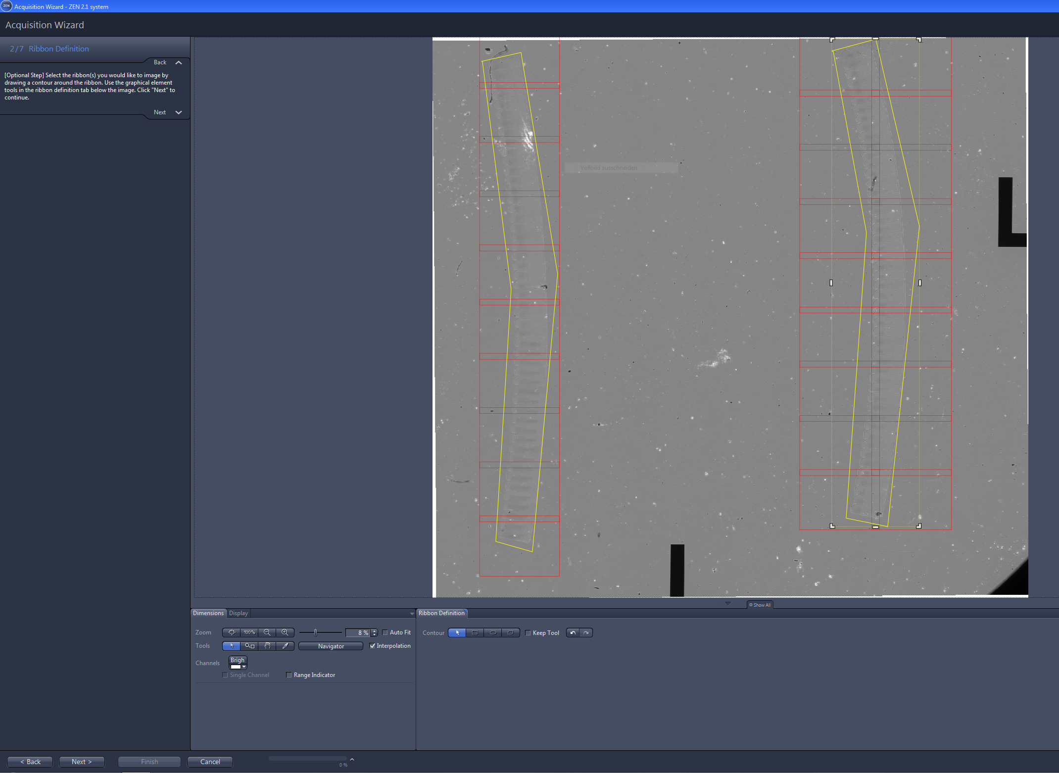 Acquisition Wizard GUI showing two long yellow ribbon contours and red tiled frames over a gray sample image