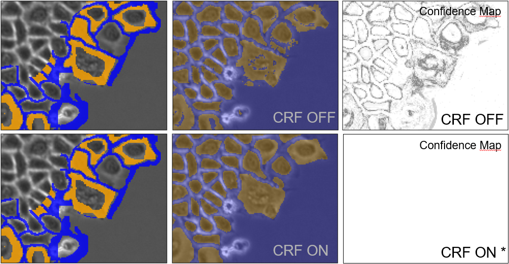 Six-panel image showing segmentation overlays on grayscale structures and text labels CRF OFF, CRF ON, and Confidence Map