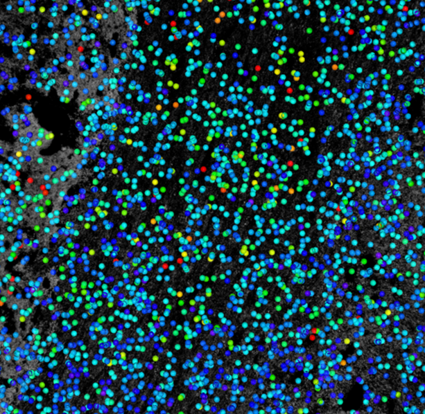 Microscopy view with hundreds of small colored circular markers (blue, cyan, green, red, yellow) over a grayscale textured background.