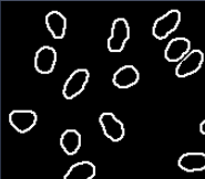 Binary outline image showing white object contours on black background