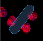 Black background with multiple red fluorescent round clusters and a large translucent blue elongated ROI outlined in light blue