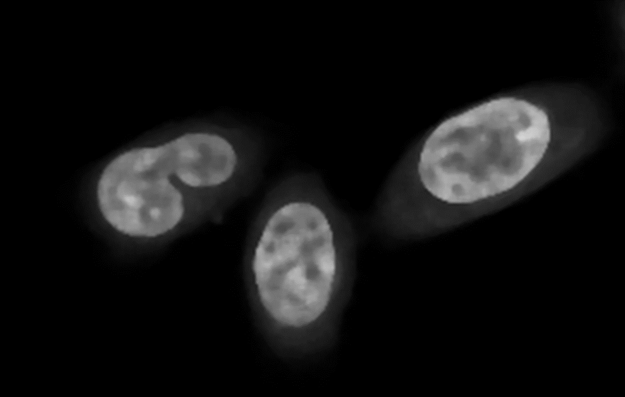 Grayscale microscope image of three cell nuclei, a zoomed pixelated nucleus, and a numeric pixel-value matrix overlay