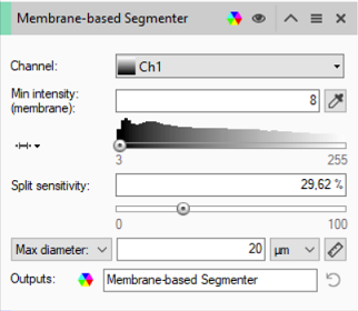 Membrane-based Segmenter: Channel Ch1; Min intensity 8; Split sensitivity 29.62%; Max diameter 20 µm