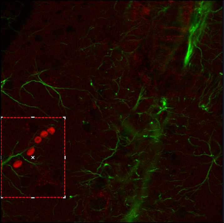 Microscopy image: green branching fibers, red oval spots, dashed red rectangle ROI at lower-left