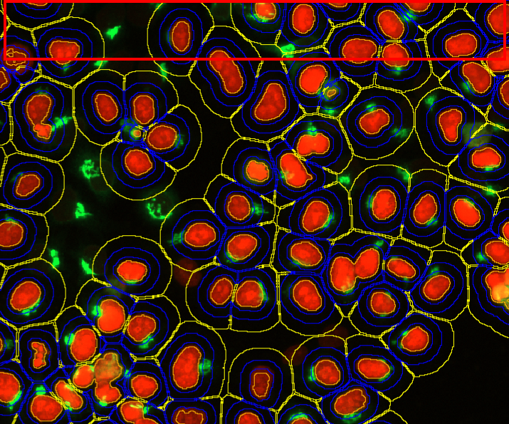 Cluster of red oval shapes with blue and yellow contour lines and green specks on a black background, red top border